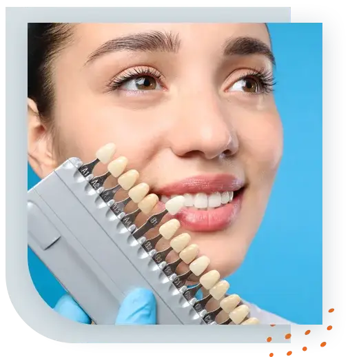 Quel type de facette dentaire choisir ? - Centre Dentaire Deramchi